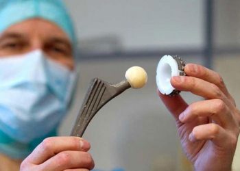 مراقبت از مفصل مصنوعی لگن