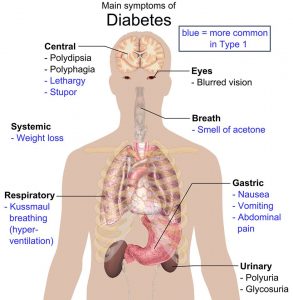 علائم اصلی دیابت