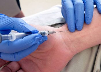 نمونه گیری خون