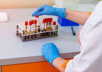 لیست کامل تست های آزمایشگاهی