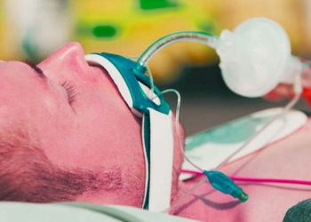 اینتوباسیون