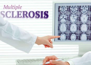 بیماری ms