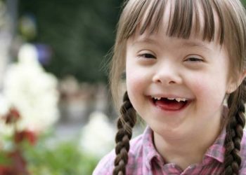 ﺑﻬﺪاﺷﺖ دﻫﺎن و دﻧﺪان‬ در کودک کم توان ذهنی