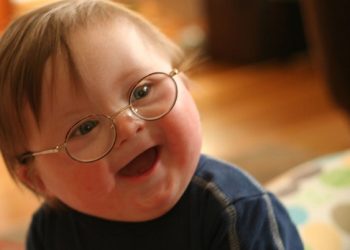 مراقبت از کودک کم توان ذهنی