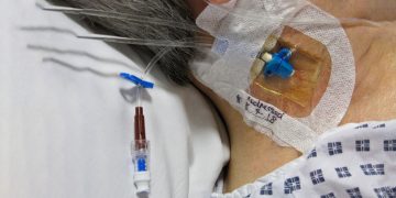 نکاتی در مورد cvp