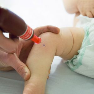 قرار دادن کاتتر در استخون اطفال