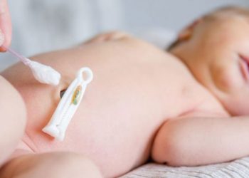 مراقبت از بندناف نوزاد