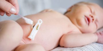 مراقبت از بندناف نوزاد