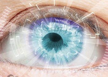 کاتاراکت یا آب مروارید